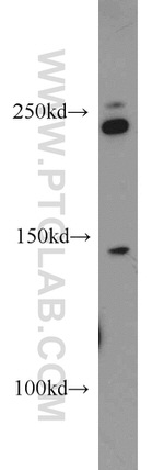 MYO9B Antibody in Western Blot (WB)