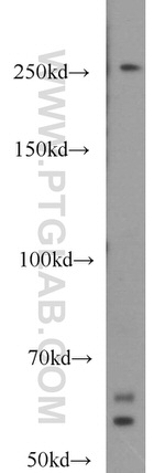 MYO9B Antibody in Western Blot (WB)