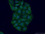 HOMER1 Antibody in Immunocytochemistry (ICC/IF)