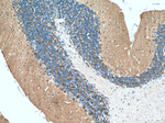 HOMER1 Antibody in Immunohistochemistry (Paraffin) (IHC (P))