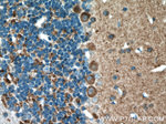 HOMER1 Antibody in Immunohistochemistry (Paraffin) (IHC (P))