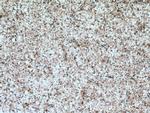 HOMER1 Antibody in Immunohistochemistry (Paraffin) (IHC (P))