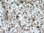 HOMER1 Antibody in Immunohistochemistry (Paraffin) (IHC (P))