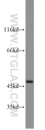 HOMER1 Antibody in Western Blot (WB)