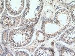 STAM Antibody in Immunohistochemistry (Paraffin) (IHC (P))