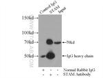 STAM Antibody in Immunoprecipitation (IP)