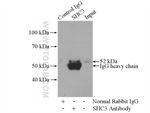 SHC3 Antibody in Immunoprecipitation (IP)