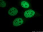 CREST Antibody in Immunocytochemistry (ICC/IF)