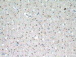 CREST Antibody in Immunohistochemistry (Paraffin) (IHC (P))