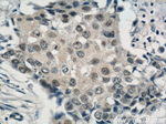 CREST Antibody in Immunohistochemistry (Paraffin) (IHC (P))