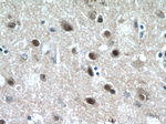 CREST Antibody in Immunohistochemistry (Paraffin) (IHC (P))