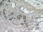 CREST Antibody in Immunohistochemistry (Paraffin) (IHC (P))