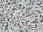 CREST Antibody in Immunohistochemistry (Paraffin) (IHC (P))