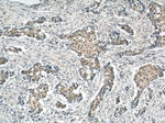 CREST Antibody in Immunohistochemistry (Paraffin) (IHC (P))