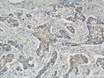 CREST Antibody in Immunohistochemistry (Paraffin) (IHC (P))