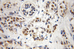 CREST Antibody in Immunohistochemistry (Paraffin) (IHC (P))