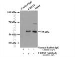 CREST Antibody in Immunoprecipitation (IP)