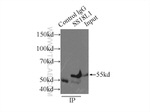 CREST Antibody in Immunoprecipitation (IP)