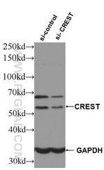 CREST Antibody in Western Blot (WB)