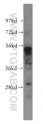 SHPK Antibody in Western Blot (WB)