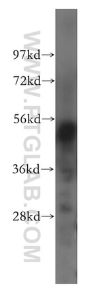 SHPK Antibody in Western Blot (WB)