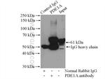 PDE1A Antibody in Immunoprecipitation (IP)