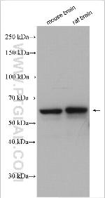 PDE1A Antibody in Western Blot (WB)