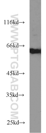 PDE1A Antibody in Western Blot (WB)