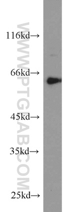 PDE1A Antibody in Western Blot (WB)