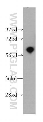 PDE1A Antibody in Western Blot (WB)