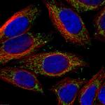 NDUFS1 Antibody in Immunocytochemistry (ICC/IF)