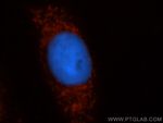 NDUFS1 Antibody in Immunocytochemistry (ICC/IF)