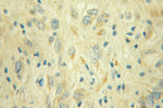 NDUFS1 Antibody in Immunohistochemistry (Paraffin) (IHC (P))