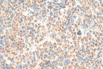 NDUFS1 Antibody in Immunohistochemistry (Paraffin) (IHC (P))