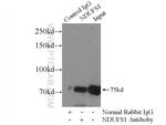 NDUFS1 Antibody in Immunoprecipitation (IP)