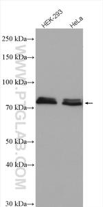 NDUFS1 Antibody in Western Blot (WB)