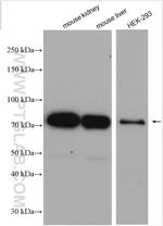 NDUFS1 Antibody in Western Blot (WB)