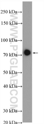 NDUFS1 Antibody in Western Blot (WB)