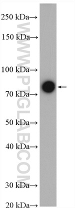 NDUFS1 Antibody in Western Blot (WB)