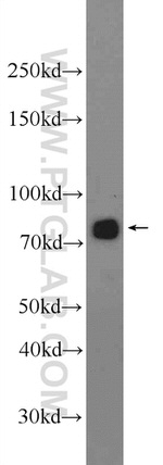 NDUFS1 Antibody in Western Blot (WB)