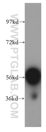 TBX6 Antibody in Western Blot (WB)