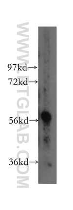 TBX6 Antibody in Western Blot (WB)