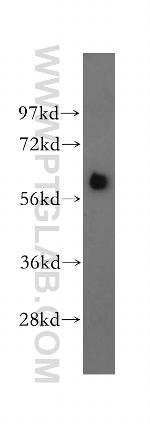 TBX6 Antibody in Western Blot (WB)