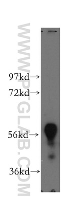 TBX6 Antibody in Western Blot (WB)