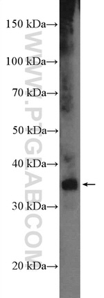 MEOX2 Antibody in Western Blot (WB)