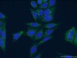 DBT Antibody in Immunocytochemistry (ICC/IF)