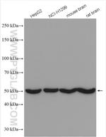 DBT Antibody in Western Blot (WB)