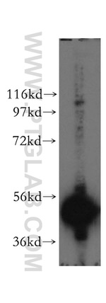 DBT Antibody in Western Blot (WB)