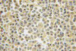 HS2ST1 Antibody in Immunohistochemistry (Paraffin) (IHC (P))