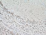 PAK4/6/7 Antibody in Immunohistochemistry (Paraffin) (IHC (P))